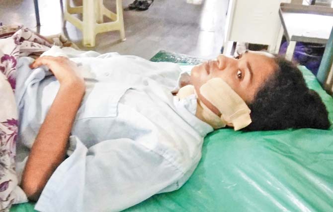 Victim Kajal Shinde recuperates at M T Agarwal Hospital in Mulund