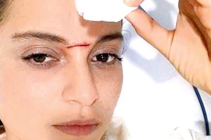 Kangana Ranaut on road to recovery after horrific accident on 'Manikarnika' sets