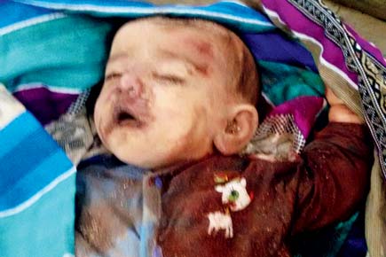Ghatkopar building collapse: Baby Veronica suffocated to death under the debris