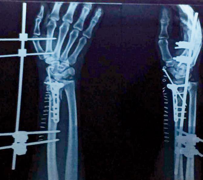 An X-Ray of Prasoon Kumar