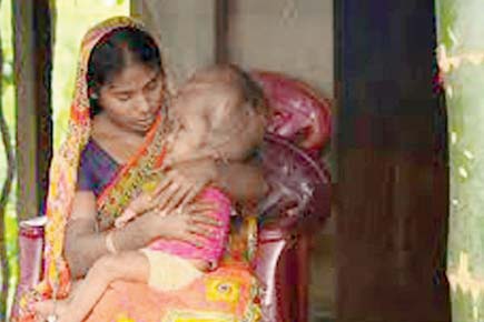 435px x 290px - Tripura's 'giant head' baby Roona passes away