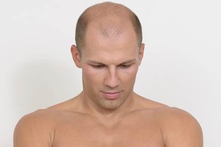Health: Why short, fair men go bald prematurely