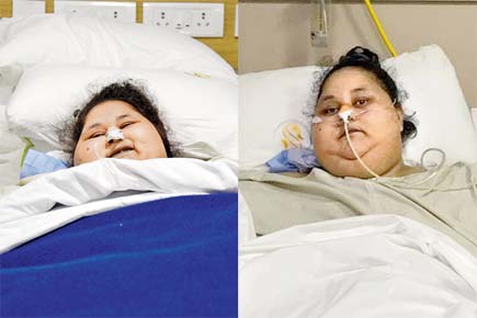 Mumbai doctors enter record books after successful operation on Eman