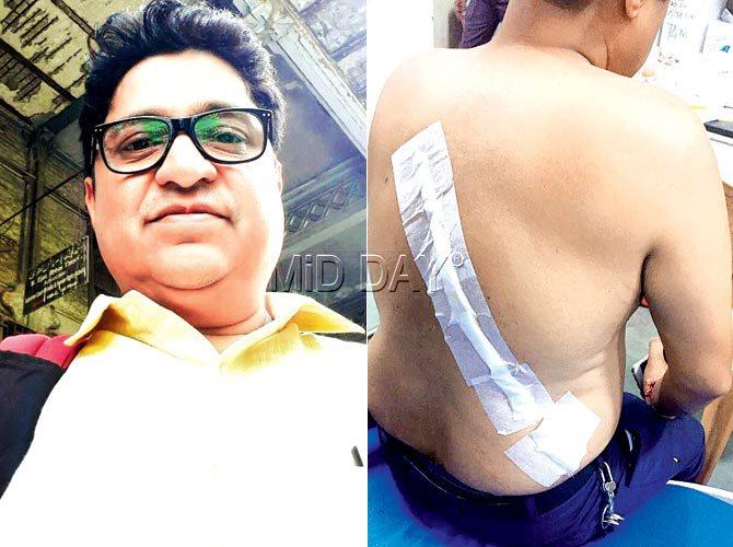 Vinod Jain was attacked on his back with a sharp object Pics/Rajesh Gupta