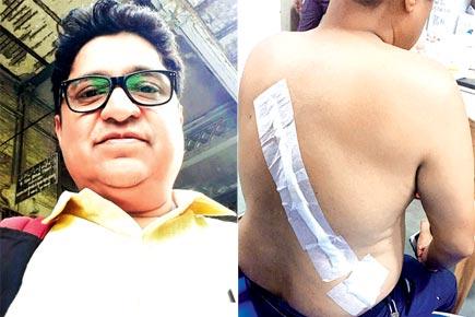 Mumbai: RTI activist attacked by two men on bike in Lalbaug