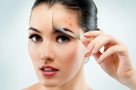 Acne care: mid-day gets experts to help you tackle pimples