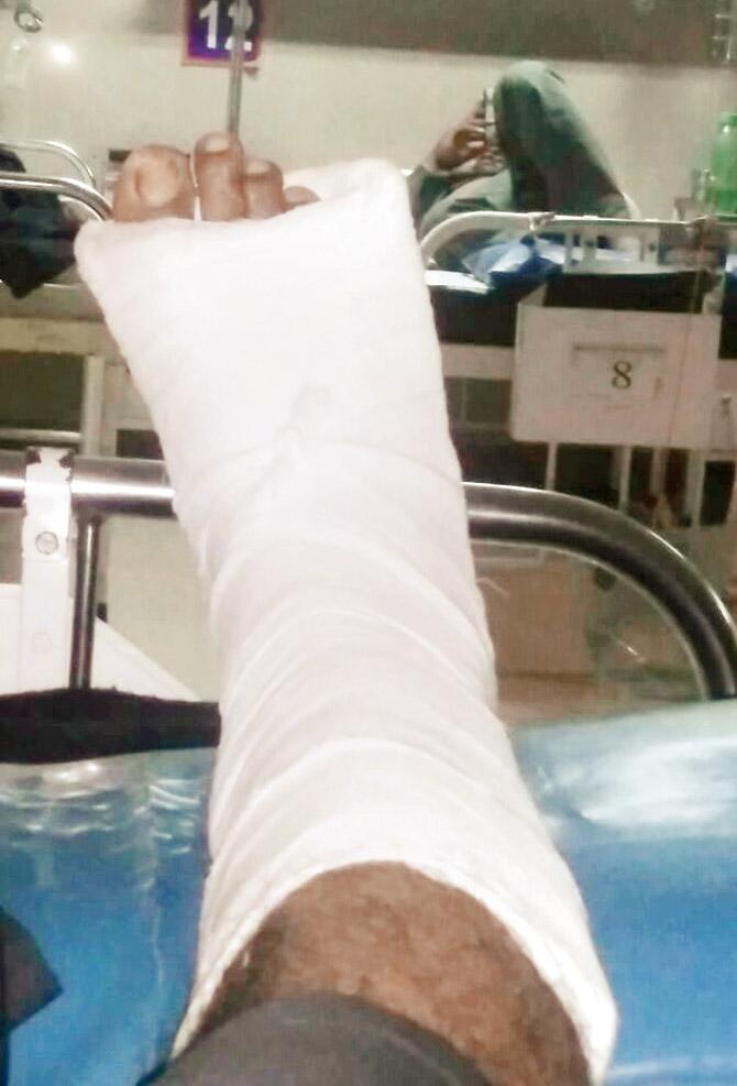 Sudhakar has suffered multiple fractures and is unable to walk