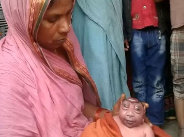 Child born with deformed features hailed as 