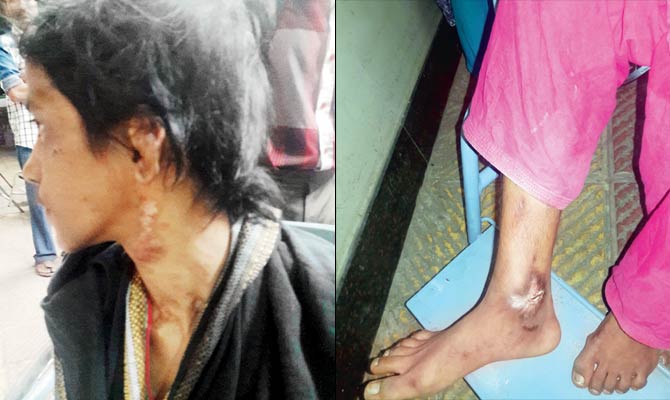Parveen Shaikh was brutally beaten up and abused for nearly four years by her two employers as well as her own aunt
