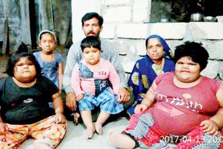 Mumbai: Inspired by Eman Ahmed, 3 obese kids admitted for life saving treatment in Saifee