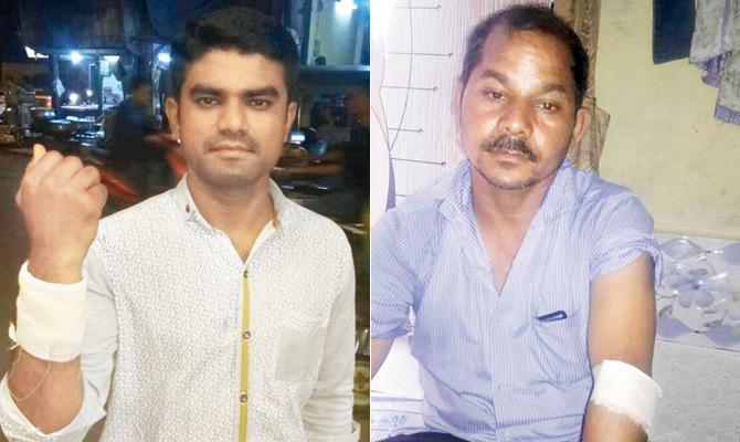 BMC security guard Chetan Patil was the first victim and Security guard Rakesh Shukla