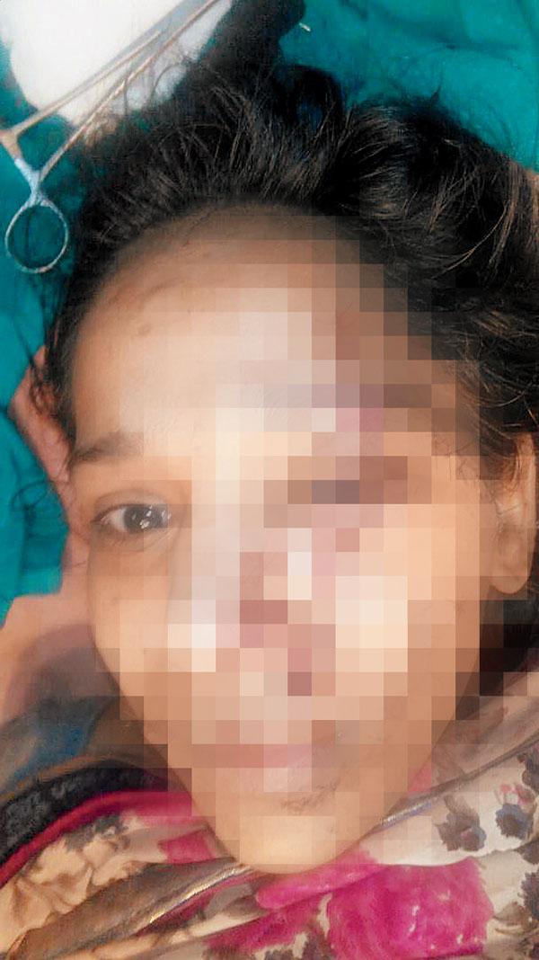Victim Rani Nitin Divte received  15 stitches on her face