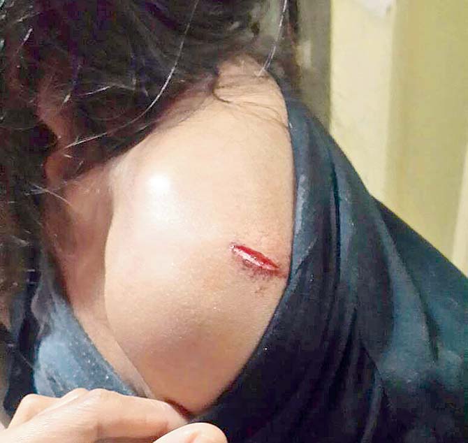 The injury Priyanka sustained after being beaten up by her mother-in-law