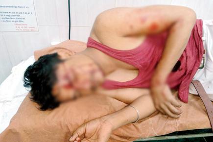 Mumbai: Drunkard assaults nurse with metal object at Byculla hospital