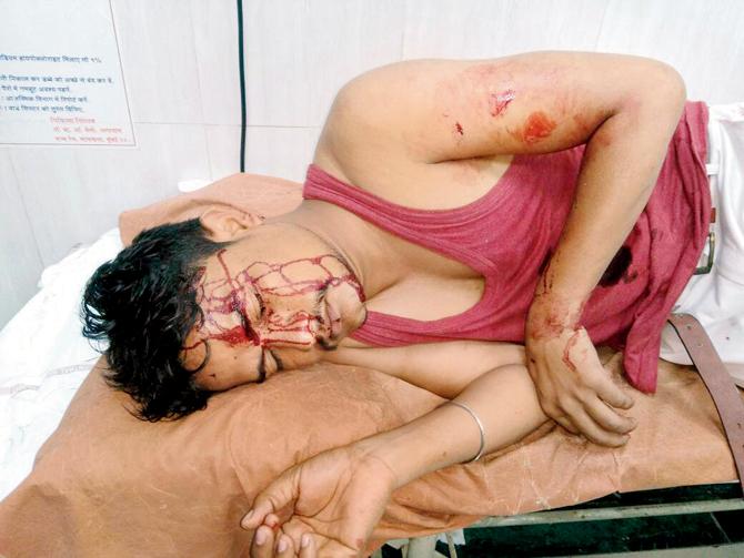 Ramesh Pawara suffered injuries in his abdomen and head
