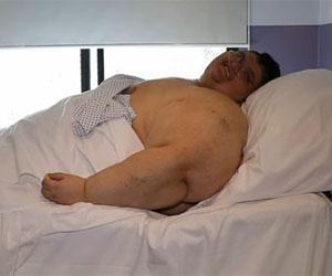 World's 'heaviest man' Juan Pedro Franco undergoes surgery