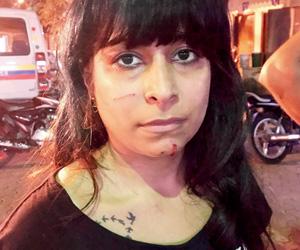 Mumbai: Sisters assaulted for feeding dogs now allege receiving threats