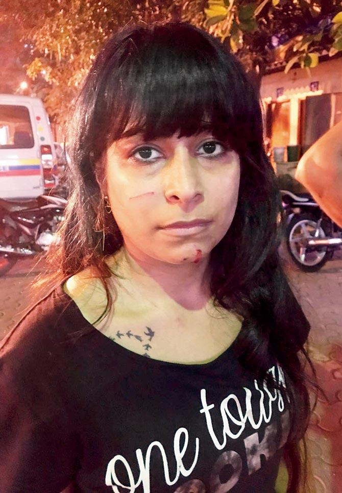 Kiran Ahuja, who was manhandled for feeding puppies in the society