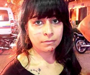 Mumbai: Sisters hounded, beaten and molested by society members for feeding dogs