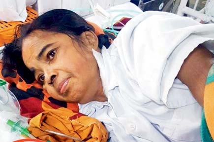 Mumbai: KEM surgeon connects part of woman's intestine with food pipe