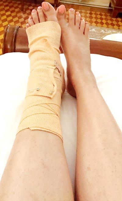 Swara Bhaskar injured leg