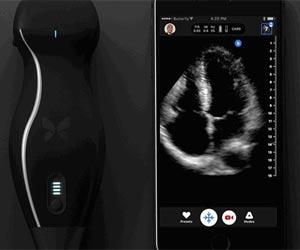 This iPhone-based ultrasound machine can detect cancer