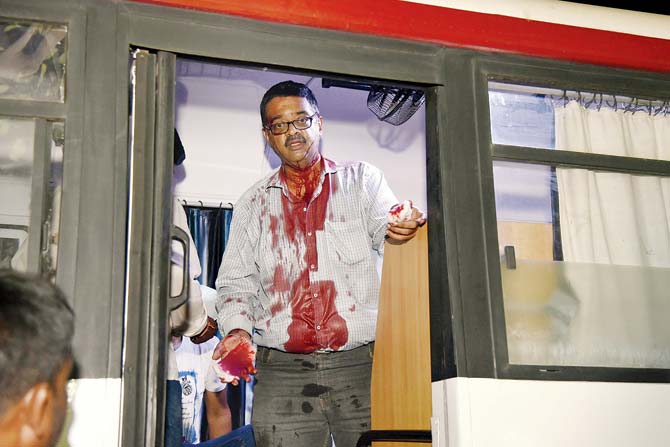 Dr Ashutosh Chaumal after the assault. Pic/ Pradeep Dhivar