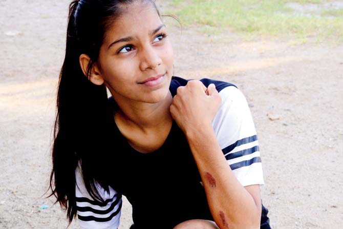Mitali Gupta displays her injuries caused by a car accident