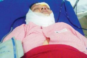 Navi Mumbai: Electrical insulator falls, 52-year-old woman seriously hurt