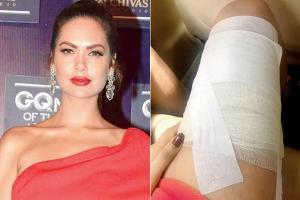 Esha Gupta injured herself during a photoshoot