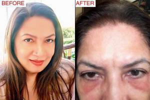 Mumbai: Woman files case vs beauty company for forging papers after botch-up