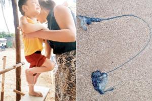 Mumbai: Blue bottle jellyfishes sting creates sensation across beaches