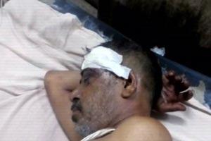 Sleeping man injured after being hit on the head with a heavy stone