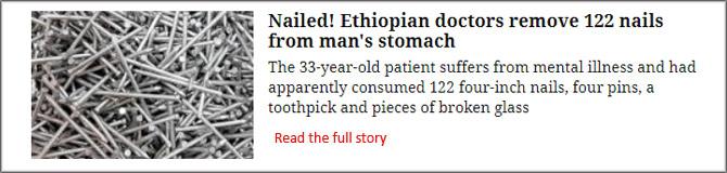 Nailed! Ethiopian Doctors Remove 122 Nails From Man