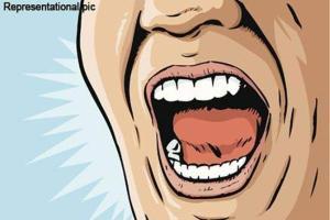 Representational picture