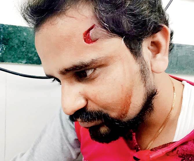 Swapnil Pawar with the gaping wound on his forehead. Pic/ Rajesh Gupta