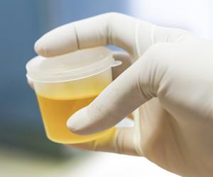 Simple urine test may predict biological age, death