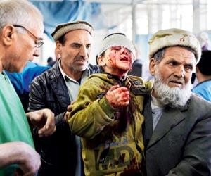 Taliban bomb in ambulance kills 95 in Kabul