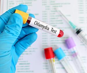 Gut exposure to chlamydia may reduce gut infection