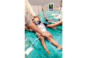 Mumbai: After three hospitals and 15-hour ordeal, toddler battles for life