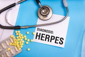 Herpes virus linked to Alzheimer's, antivirals may help