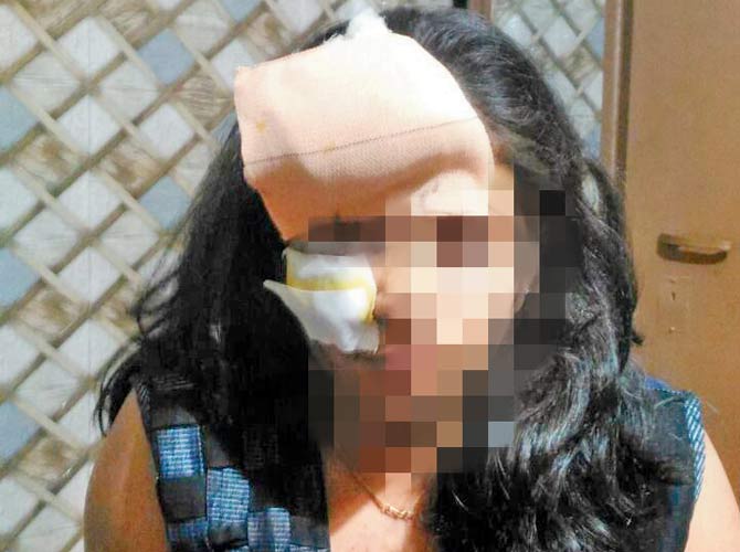 Bhavana Murpani fell unconscious when glass shards got lodged in her face