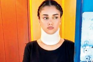 Aditi Rao Hydari shoot for her film despite neck injury
