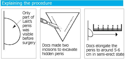 Explaining the procedure