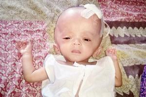Mumbai: Baby Eliza's condition worsens, but hospital refuses admission