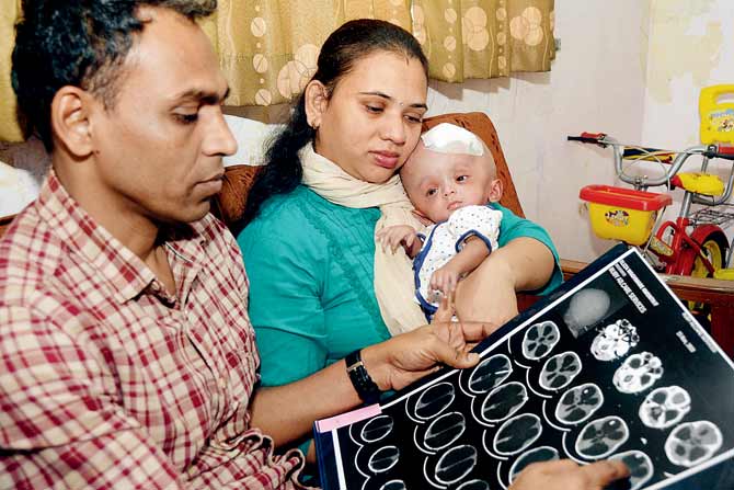 Anand and Jayanti Waghmare with five-month-old daughter Eliza, who was born with hydrocephalus