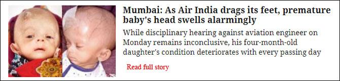 Mumbai: After emergency procedure, help pours in for baby Eliza who is battling condition rare 