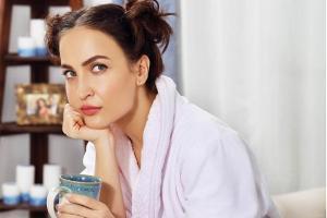 Elli AvrRam burns her leg while performing an act at The Dance Project