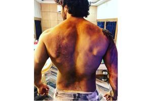See photo: Varun Dhawan gets battle scars on 'Kalank' set 