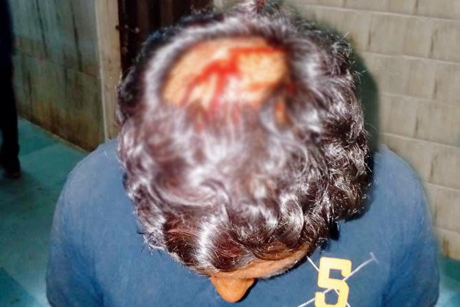 On the head with a bamboo pole on Wednesday night